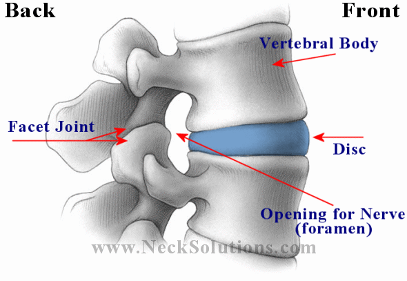 Outside Disc Lower Back