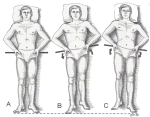 Another Back Strain Stretch - Click to Enlarge