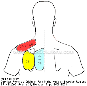 tone Tempel Moderat Pinched Nerve In Neck - Symptoms, Causes & Treatments