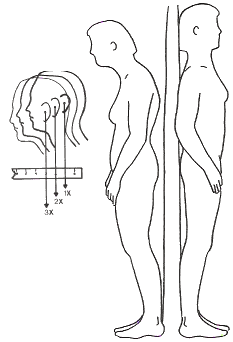 Check Your Neck Posture