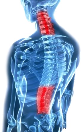 What are some symptoms of degenerative disc disease in the thoracic spine?