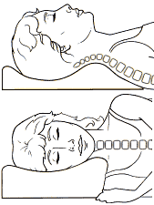 sleeping with neck pain