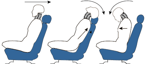 Whiplash Neck Injury Risks Effects Prevention