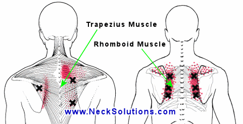 How can I reduce knots in my shoulders (trapezius muscles