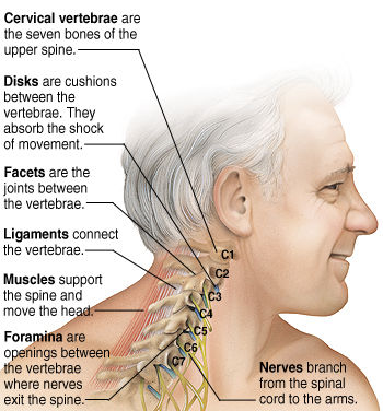 about neck pain