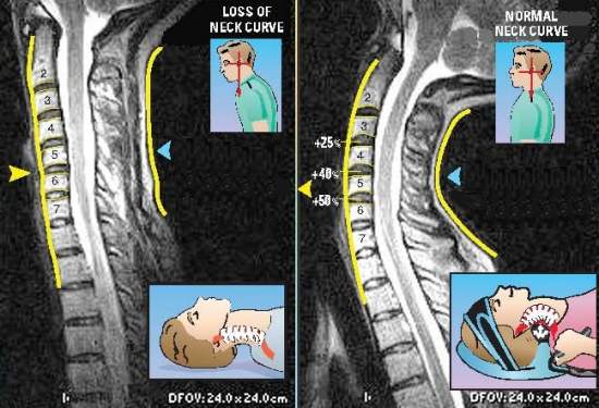 expand your spine mri studies