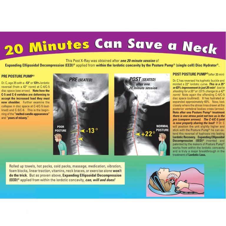Home Neck Traction Cervical Curve Restoration