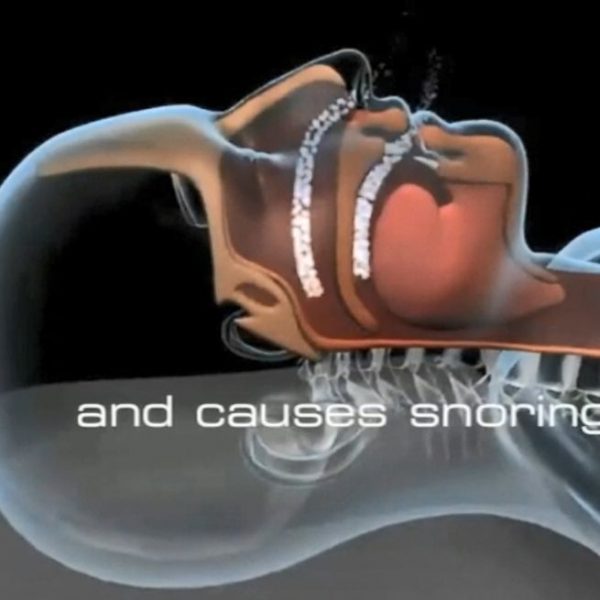 Anti Snore Pillow Anti Snoring Pillows Fact Or Fiction