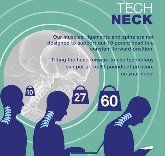 tech neck symptoms