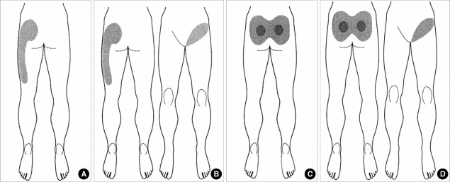 si joint symptoms