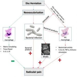 Modic Changes - Spinal Disease Or Normal Finding?